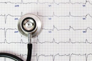 Deteksi Aritmia Jantung dengan Sinyal ECG dan XGBoost
